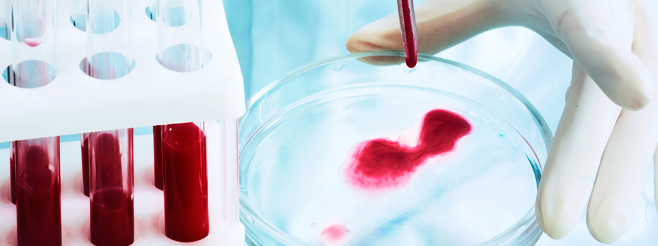 malattie-sangue-infetto.jpg malattie-sangue-infetto.jpg